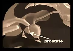 粗暴地把一个黑发穿着长袜放在屁股上，并在肛门上砸了一个大洞